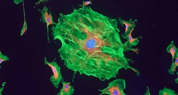 Leczenie na poziomie biochemii komórki, czyli medycyna mitochondrialna